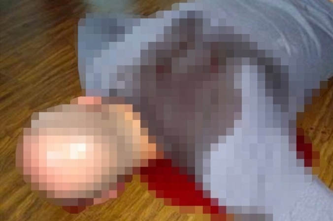 Dieses vom ukrainischen Geheimdienst inszenierte und verbreitete Bild des angeblich tot aufgefundenen Babtschenko wurde in den westlichen Medien wenig publiziert. Hier ist eine verpixelte Version zu sehen, die u.a. auf der russischen Website &quot;dayonline&quot; veröffentlicht wurde.  